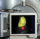 Advanced image guided radiotherapy and motion management products 